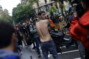 Un hombre muestras las heridas que le provocaron tras la policía trató de impedir la realización del referendo independentista, considerado ilegal por el gobierno central de Madrid. Barcelona.(AP Photo/Emilio Morenatti)